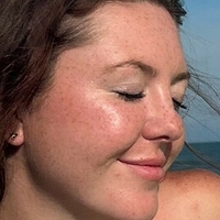 gingerfreckles Meztelen