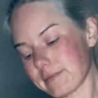 kaepiglet Meztelen