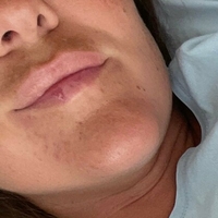 naughty_katarina_free Meztelen