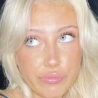 Notkayyybaby Meztelen