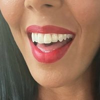 rachelstarrxxx Meztelen