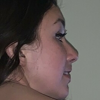 Ronisofine Meztelen