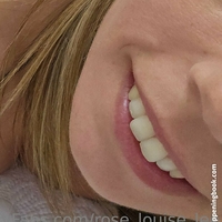 rose_louise_lee Meztelen