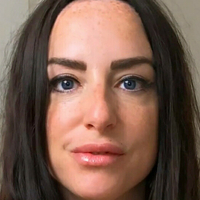 scarred4life3 Meztelen