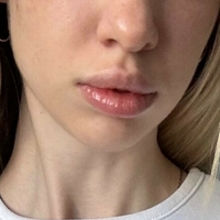 shellysecret Meztelen