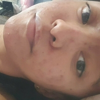xsugarvulpesx Meztelen